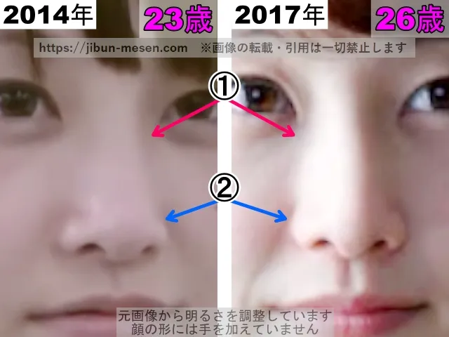 松井玲奈の鼻の整形検証2014年～2017年（拡大）