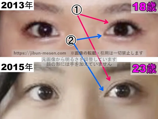 松岡茉優の目の整形検証2013年〜2015年（拡大）