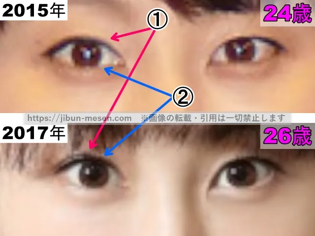 松井玲奈の目の整形検証2015年～2017年（拡大）