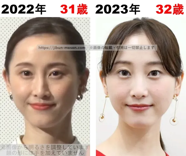 松井玲奈の整形検証2022年~2023年