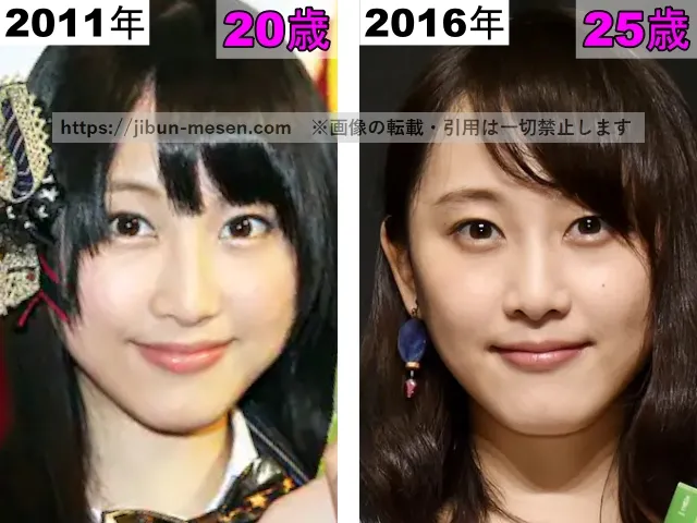 松井玲奈の唇の整形検証2011年～2016年
