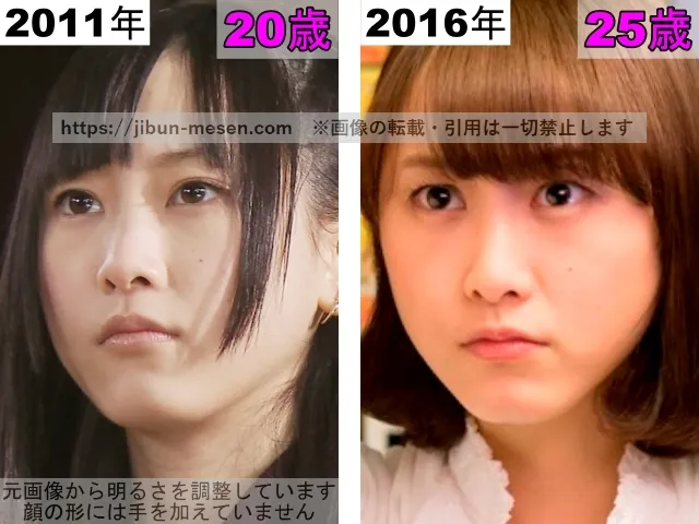 松井玲奈の唇の整形検証2011年～2016年その2