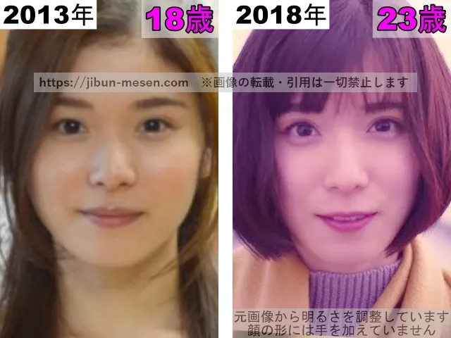 松岡茉優の鼻の整形検証2013年〜2018年