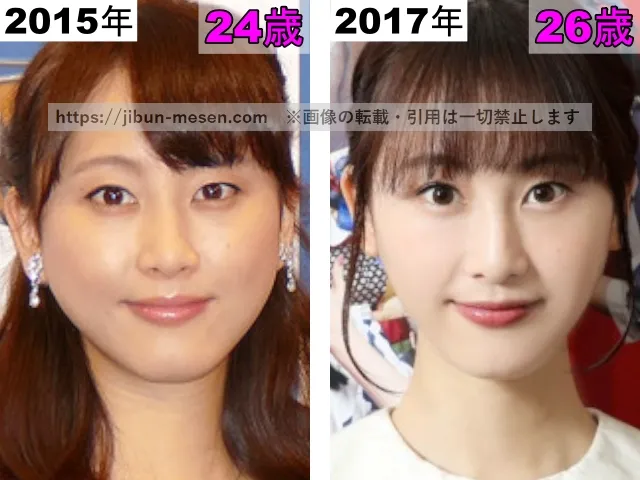 松井玲奈の目の整形検証2015年～2017年