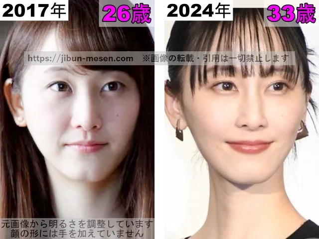 松井玲奈の鼻の整形検証2017年～2024年