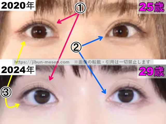 松岡茉優の目の整形検証2020年〜2024年（拡大）