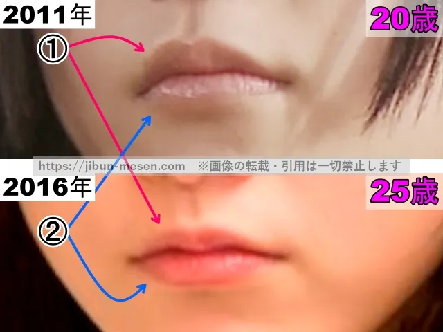 松井玲奈の唇の整形検証2011年～2016年その2（拡大）