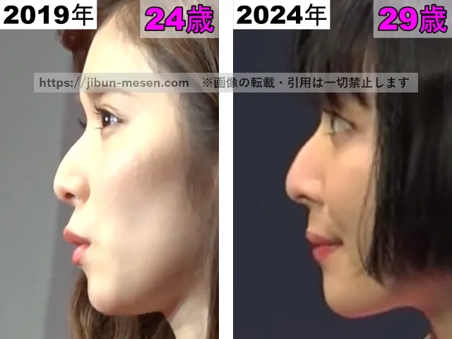 松岡茉優の鼻の整形検証2019年〜2024年