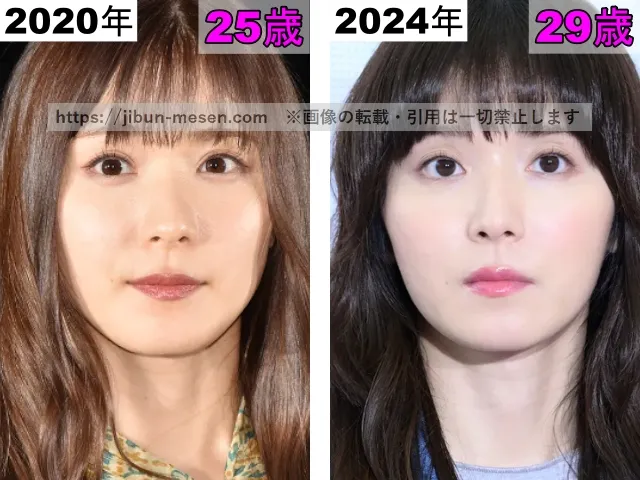 松岡茉優の目の整形検証2020年〜2024年