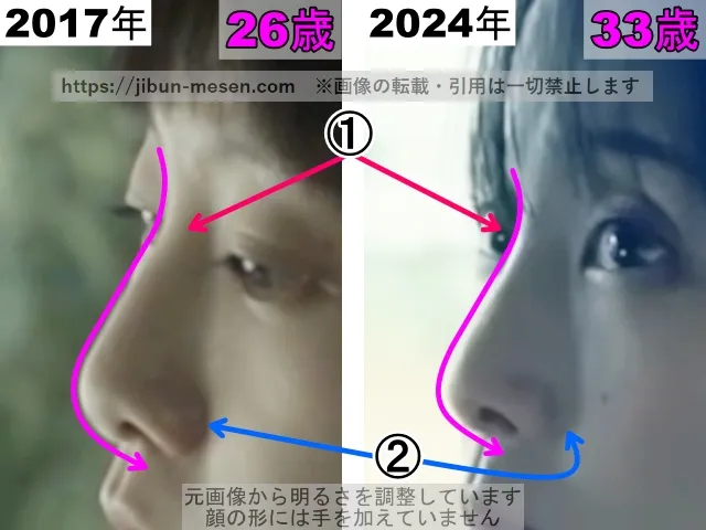 松井玲奈の鼻の整形検証2017年～2024年（横顔・拡大）