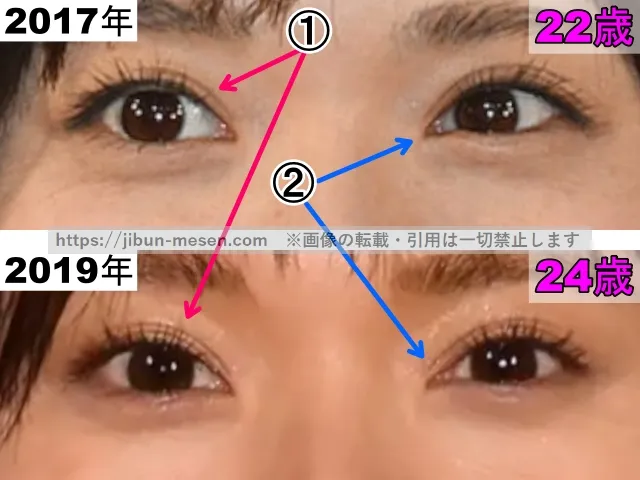 松岡茉優の目の整形検証2017年〜2019年（拡大）