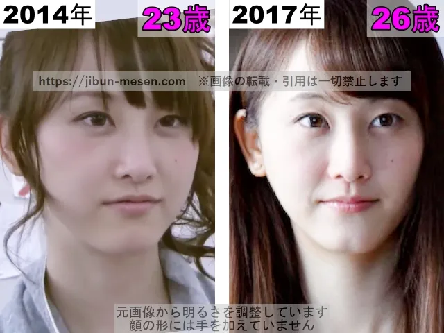 松井玲奈の鼻の整形検証2014年～2017年