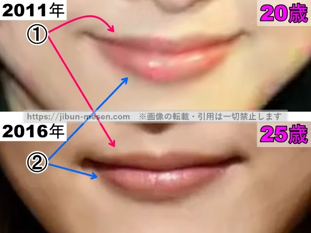 松井玲奈の唇の整形検証2011年～2016年（拡大）