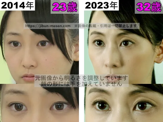 松井玲奈のまぶたの比較2014年～2023年