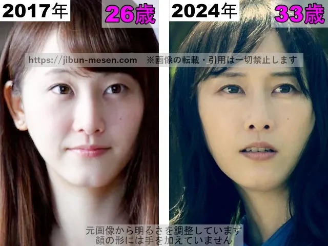 松井玲奈の顎の整形検証2017年～2024年