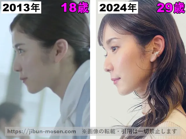 松岡茉優の口の整形検証2013年〜2024年(横顔)