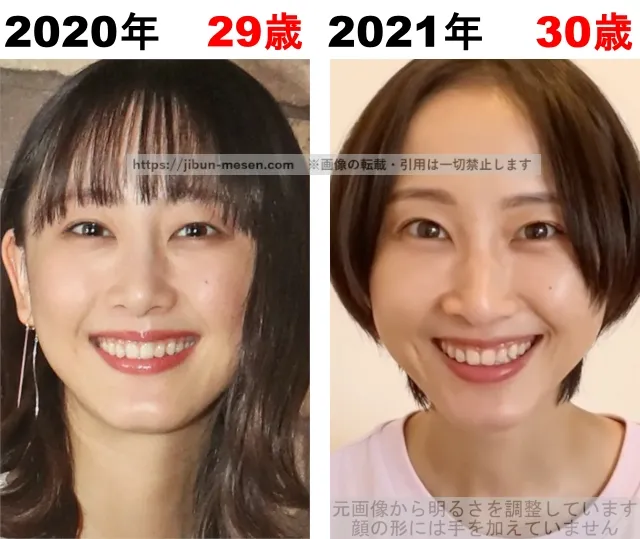 松井玲奈の整形検証2020年~2021年