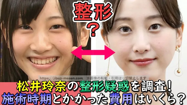 松井玲奈の整形の記事