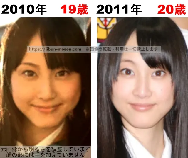 松井玲奈の整形検証2010年~2011年