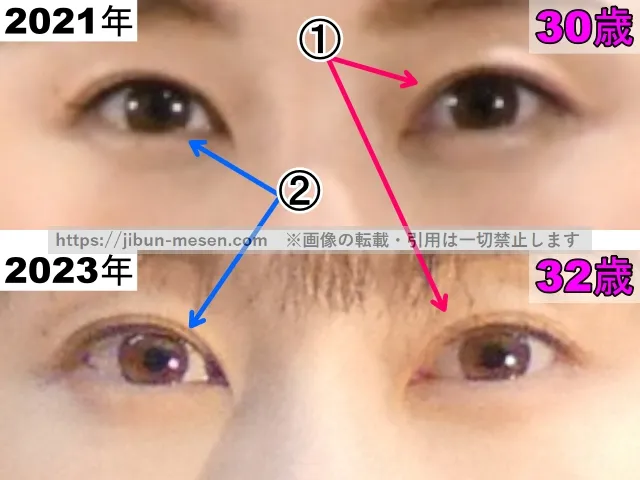 松井玲奈の目の整形検証2021年～2023年（拡大）