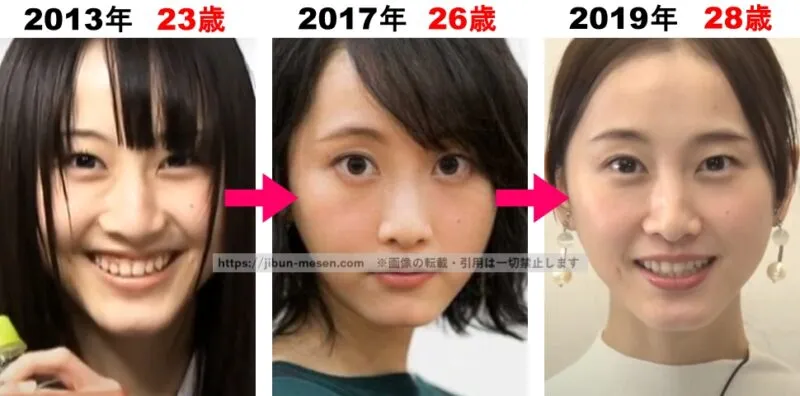 松井玲奈の前髪の変化