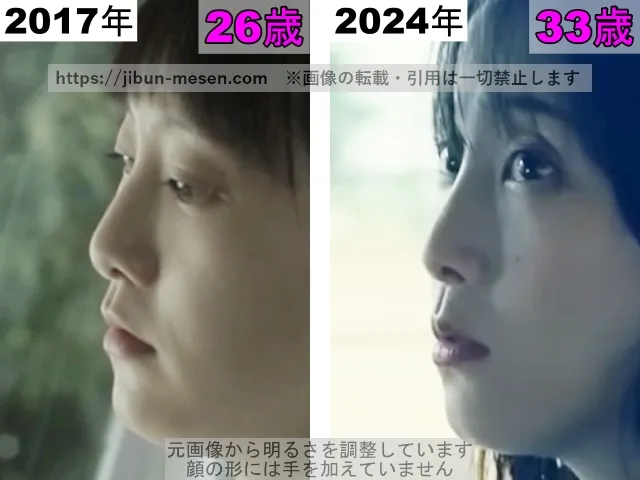 松井玲奈の鼻の整形検証2017年～2024年（横顔）