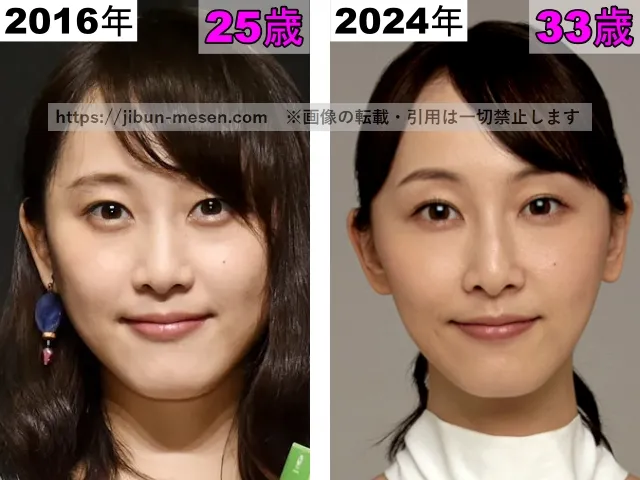 松井玲奈の唇の整形検証2016年～2024年