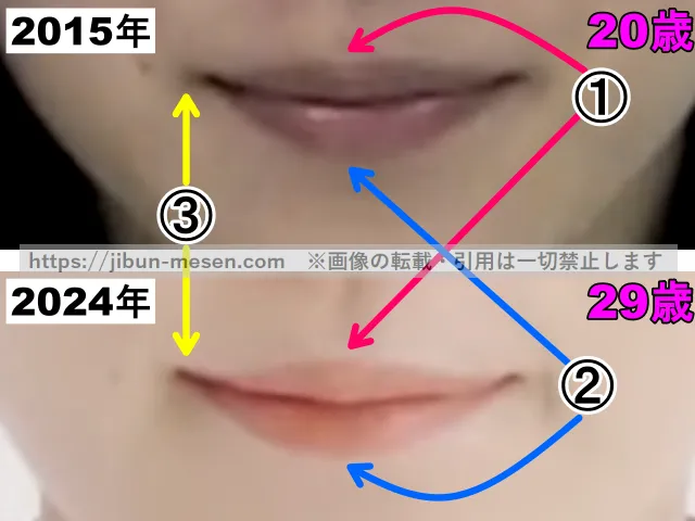 松岡茉優の口の整形検証2015年〜2024年(拡大)