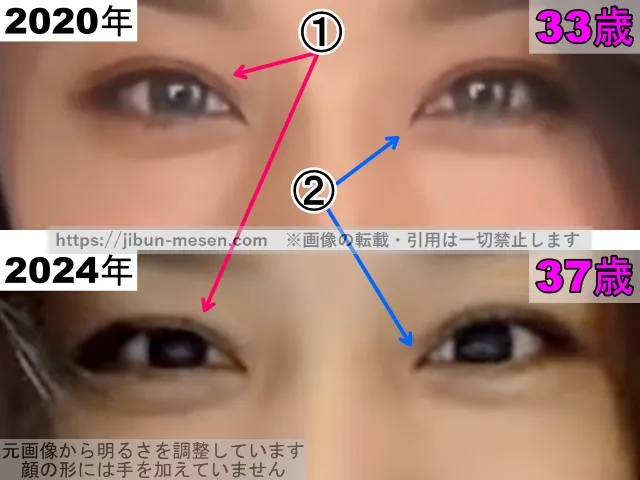 高橋メアリージュンの目の整形検証2020年〜2024年（拡大）