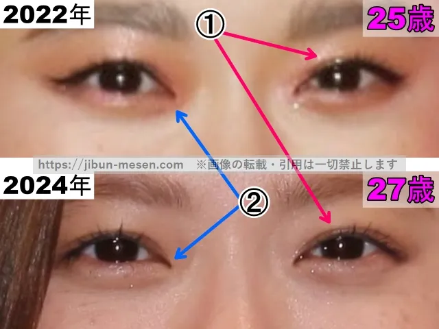 杉咲花の目の整形検証2022年〜2024年（拡大）