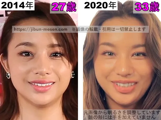 高橋メアリージュンの目の整形検証2014年〜2020年