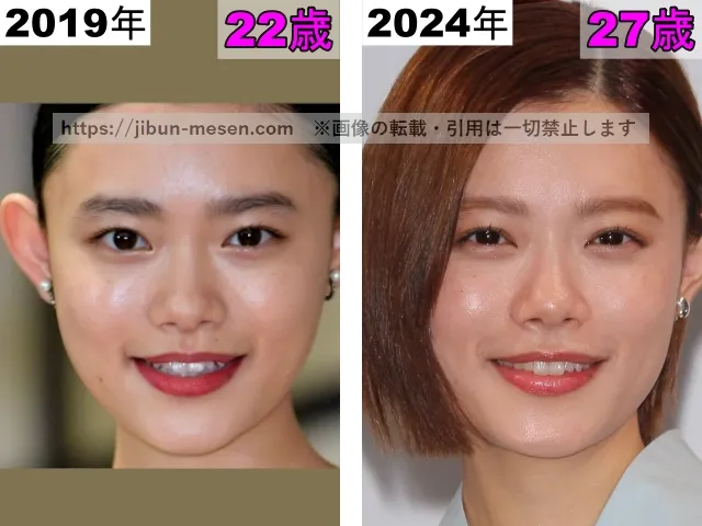 杉咲花の唇の整形検証2019年〜2024年