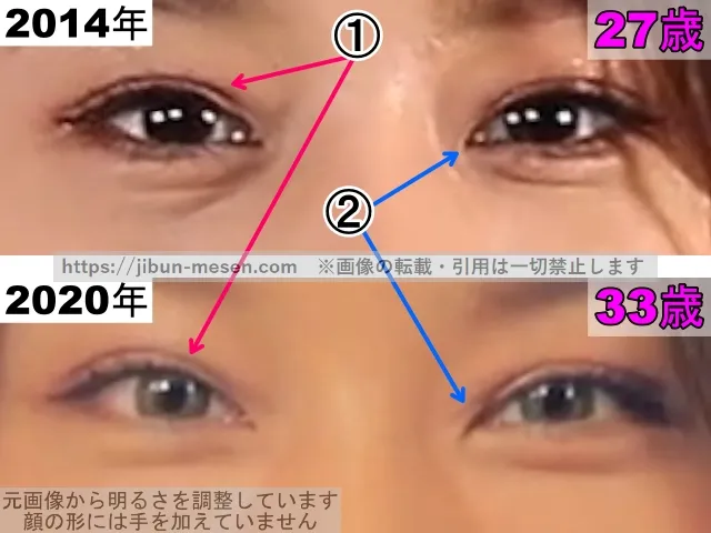 高橋メアリージュンの目の整形検証2014年〜2020年（拡大）