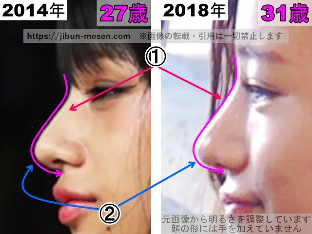高橋メアリージュンの鼻の整形検証2014年〜2018年（横顔・拡大）
