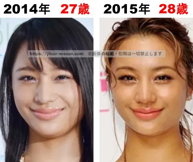 高橋メアリージュンの整形検証2014年〜2015年