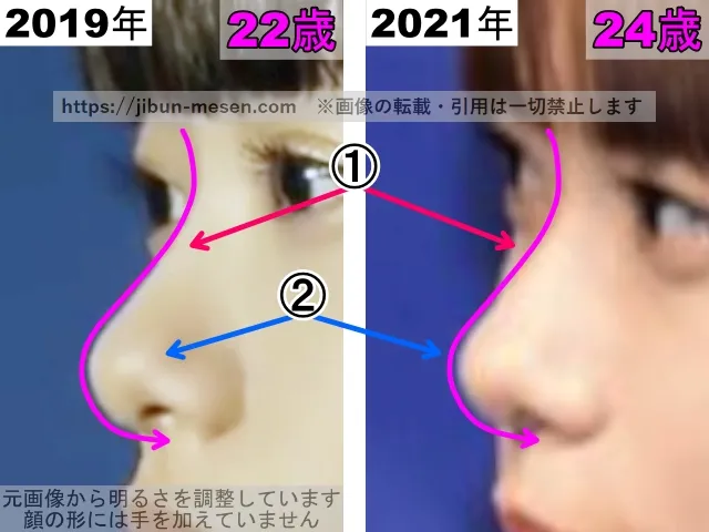 杉咲花の鼻の整形検証2019年〜2021年（拡大）