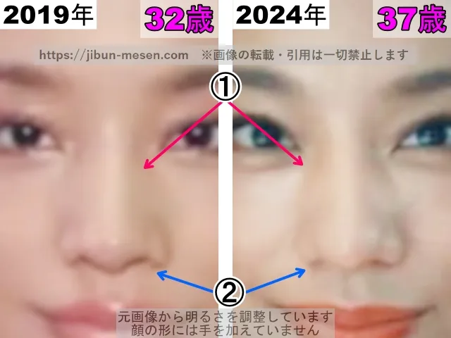 高橋メアリージュンの鼻の整形検証2019年〜2024年（拡大）