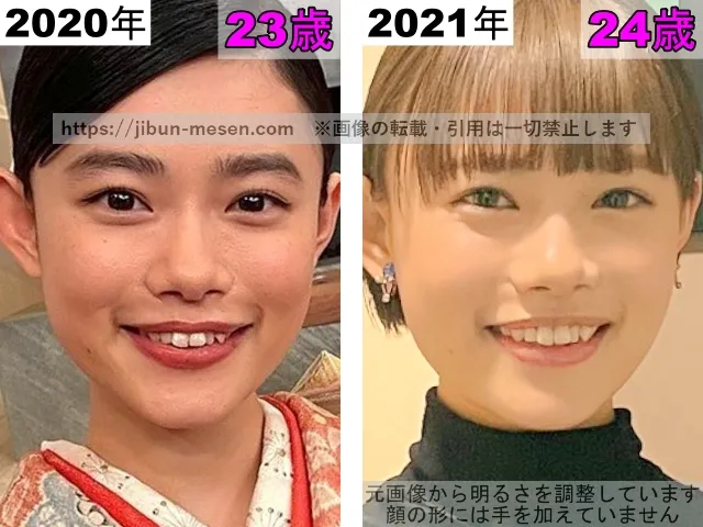 杉咲花の鼻の整形検証2020年〜2021年