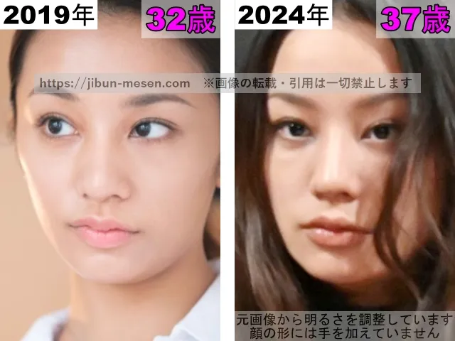 高橋メアリージュンの唇の整形検証2019年〜2024年