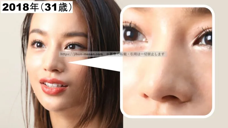 高橋メアリージュンの鼻柱の位置