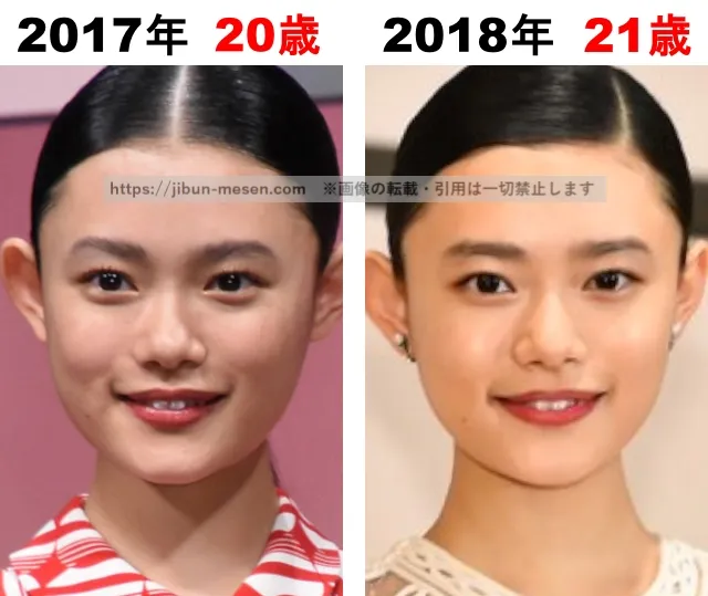 杉咲花の整形検証2017年〜2018年