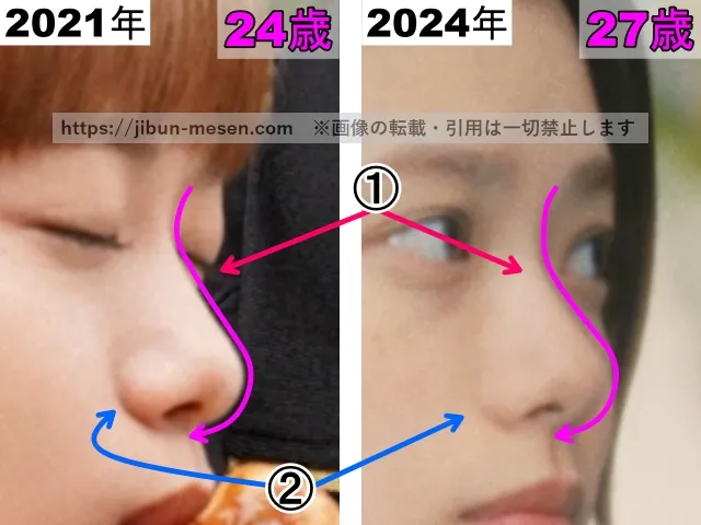 杉咲花の鼻の整形検証2021年〜2024年（横顔・拡大）