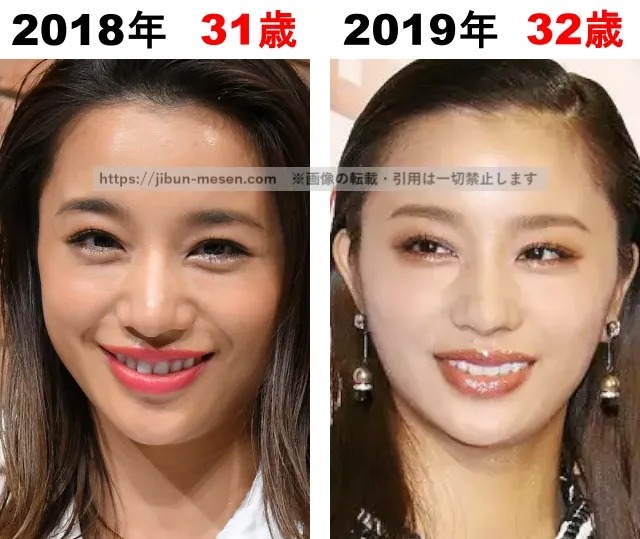 高橋メアリージュンの整形検証2018年〜2019年