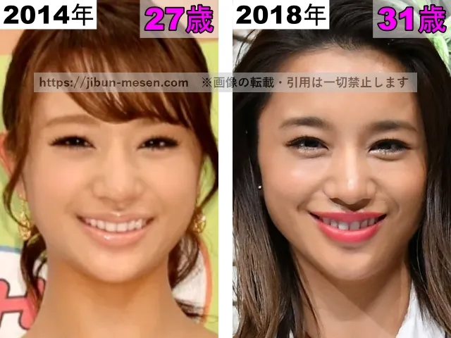 高橋メアリージュンの鼻の整形検証2014年〜2018年
