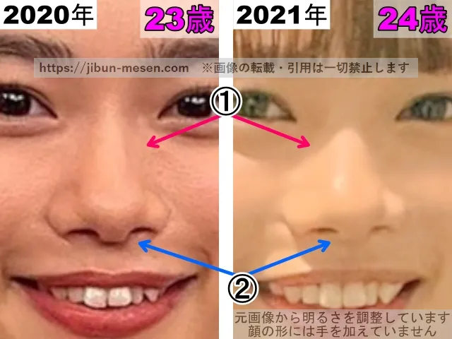 杉咲花の鼻の整形検証2020年〜2021年（拡大）