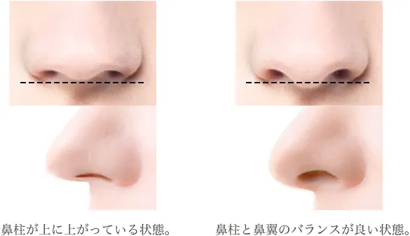 鼻柱のバランス（マックスファクス銀座クリニックHPより引用）