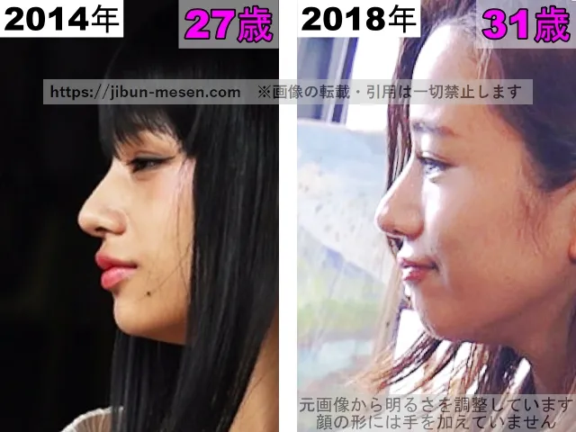 高橋メアリージュンの鼻の整形検証2014年〜2018年（横顔）