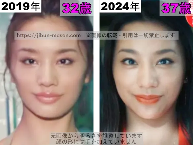 高橋メアリージュンの鼻の整形検証2019年〜2024年