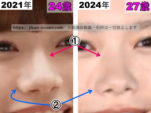 杉咲花の鼻の整形検証2021年〜2024年（拡大）