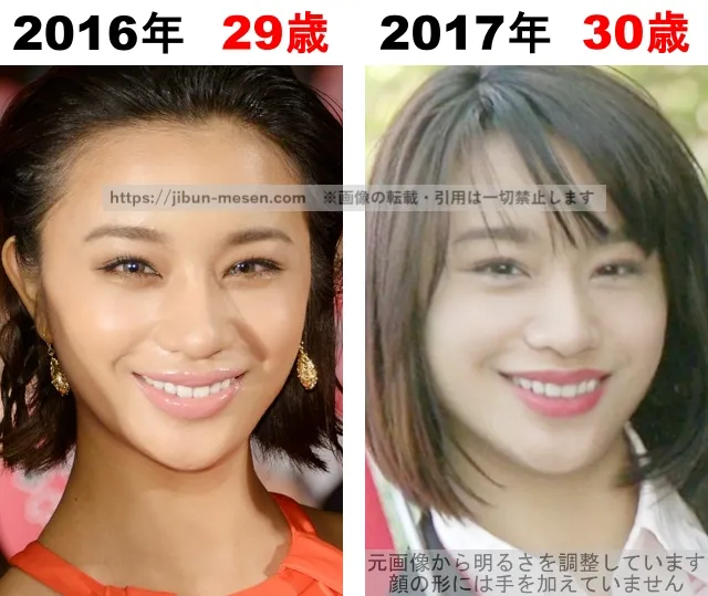 高橋メアリージュンの整形検証2016年〜2017年